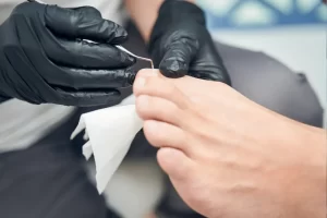 Upoštevanje sladkorne bolezni pri izvajanju pedikure (diabetično stopalo)