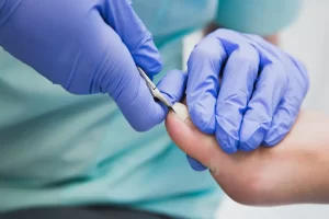 Najpogostejši vzroki za vraščen noht na nogi in kako jih odpraviti