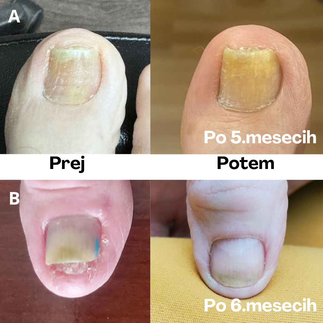 Alternative view of ACESO DEBRIDER 60ml