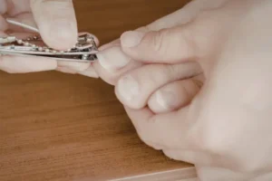 Kako zmehčati nohte na nogah, ko jih je težko striči?